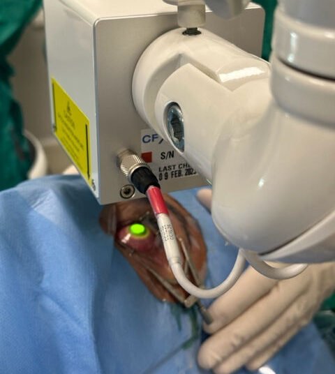 Trattamenti salva cornea